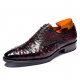 Ostrich Cap-Toe Lace-up Oxford Dress Shoes